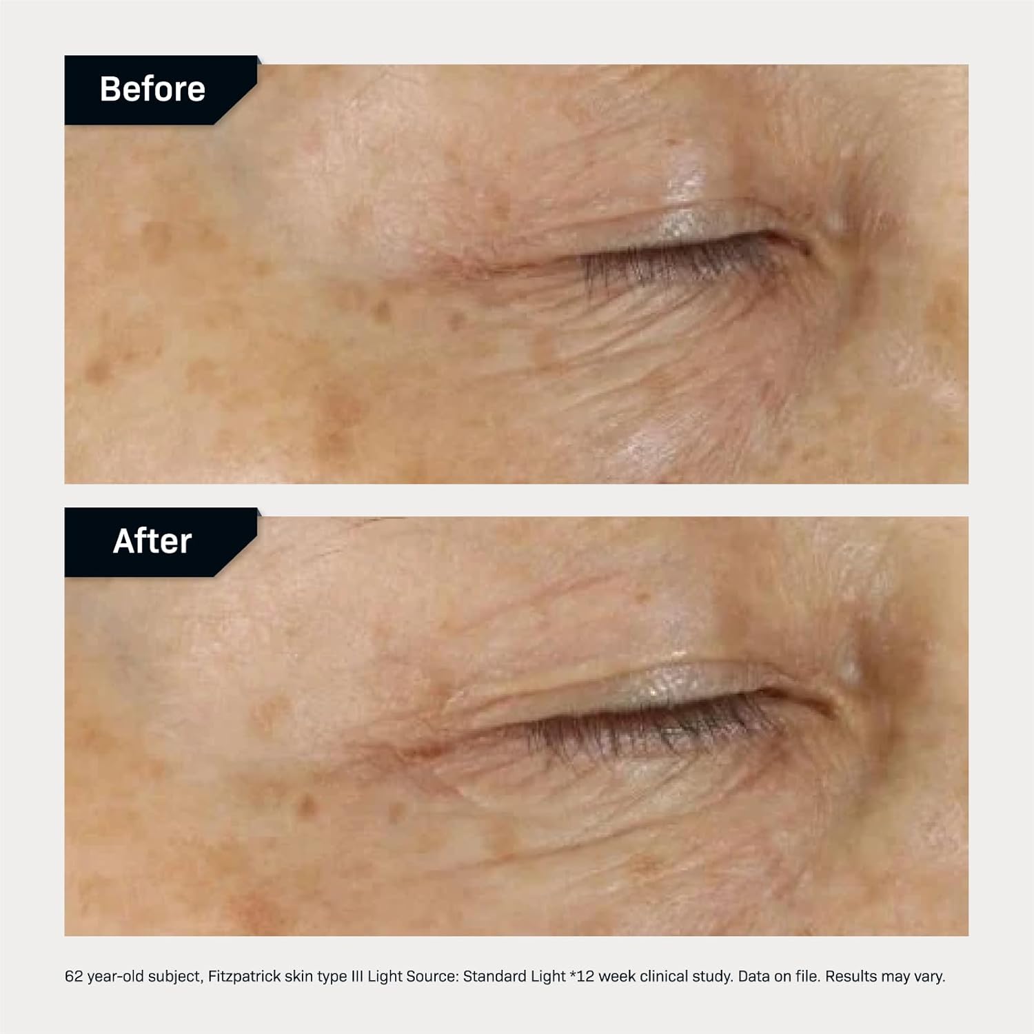 Revision Skincare D·E·J Eye Cream®, Firming and Moisturizing Treatment for Fine Lines, Wrinkles and Crow’s Feet