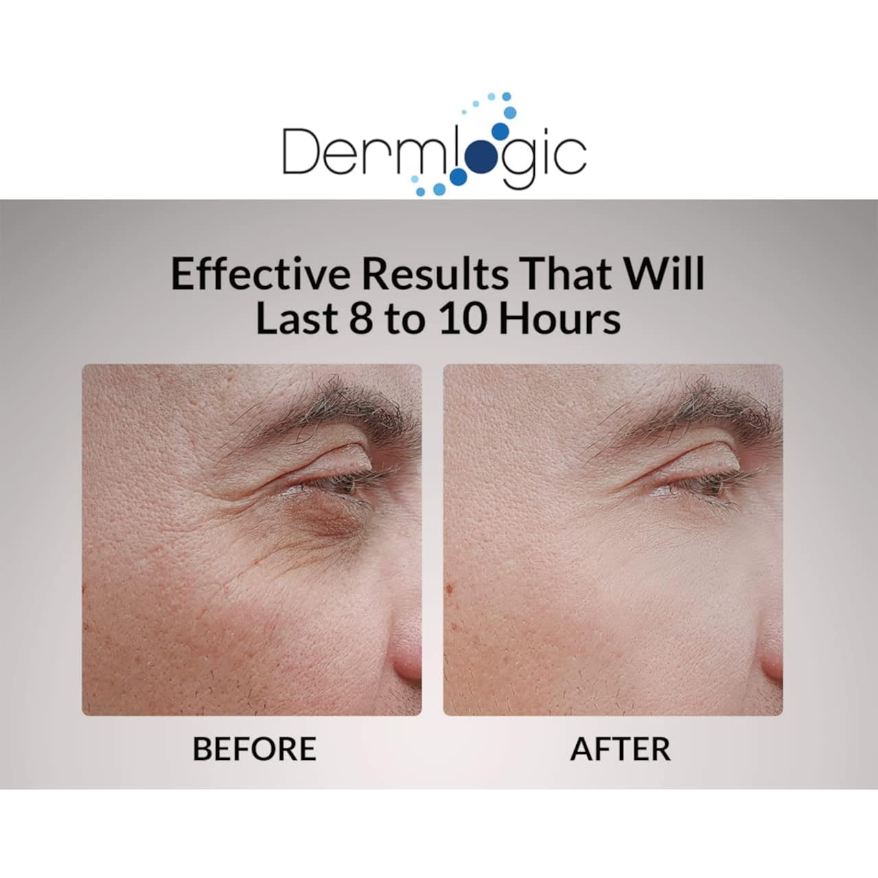 Under Eye Puffiness & Dark Circles Rapid Treatment- Instantly Reduces the Appearance of Puffy Eye Bags, Crow’s Feet, & Sagging Skin.