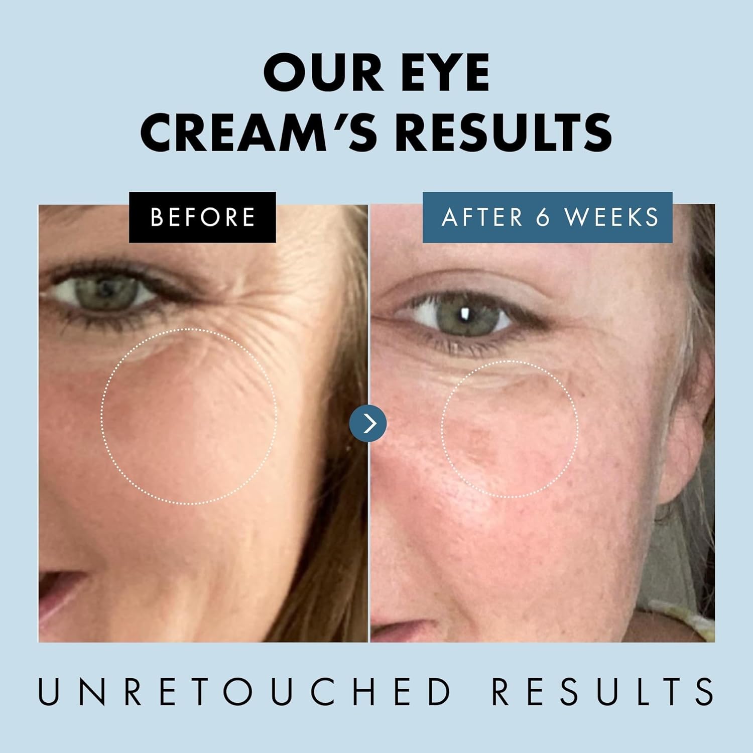 Eclat Skincare Under Eye Cream for Dark Circles & Puffiness – Anti Aging Formula for Wrinkles - Moisturizer for Fine Lines, Crows Feet & Eye Bags – Hydrating Treatment for Firming & Smoothing 30ml