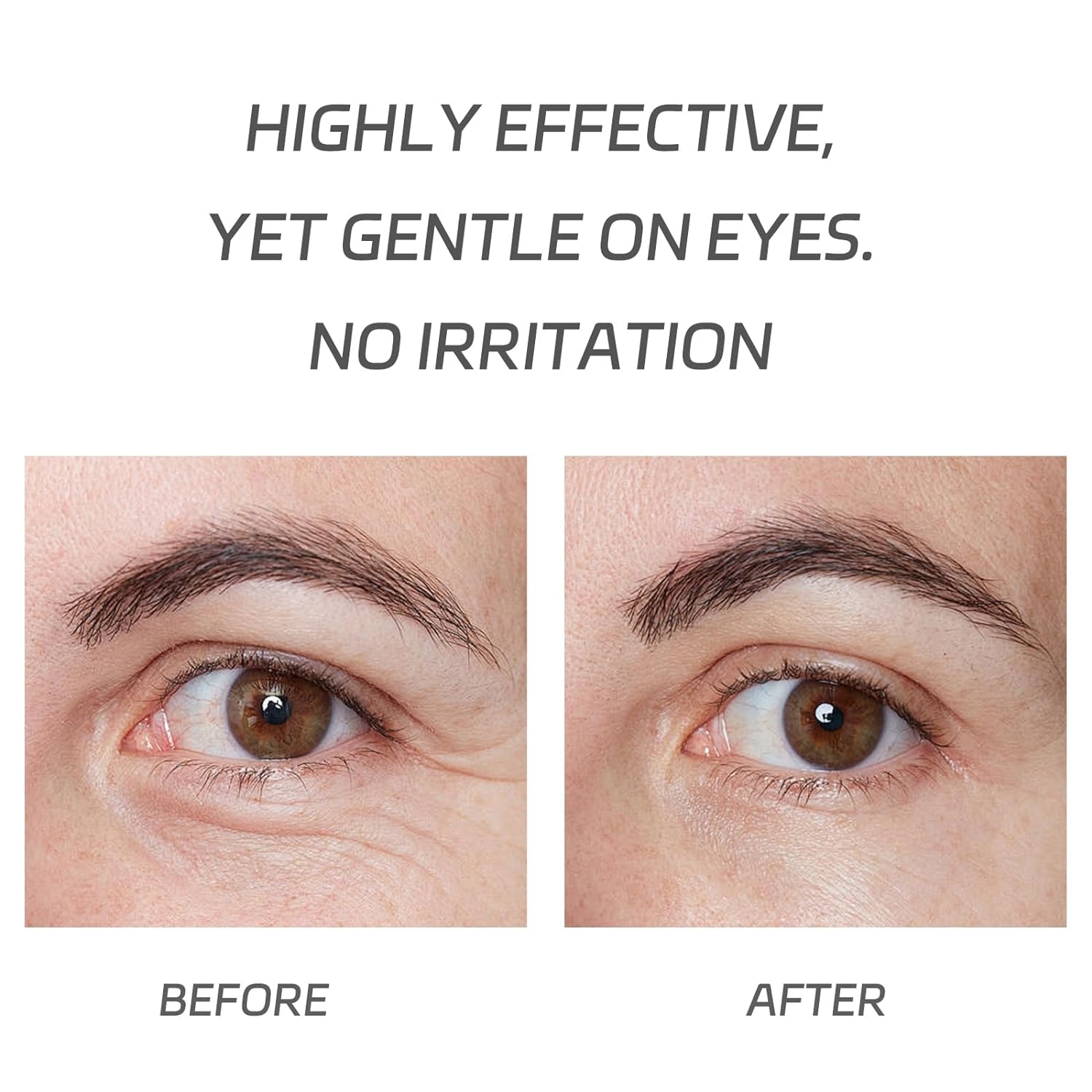 VGO Eye Cream 2% Pro-Xylane Eye Repair Cream for Dark Circles & Puffiness Under Eyes, Pro Xylane + 6D Hyaluronic Acid to Firm Skin, Reduce Wrinkles, Fine Lines, 15g/0.5 Oz