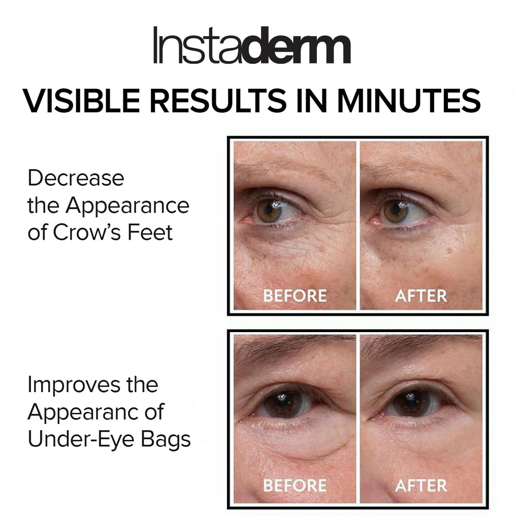 Instant Puffy Eye & Lift Treatment – Removes Under Eye Bags & Puffiness. Eliminate Dark Circles & Wrinkles. Naturally Ageless Hydrating Cream. Disappears Before Your Eyes Within Minutes.