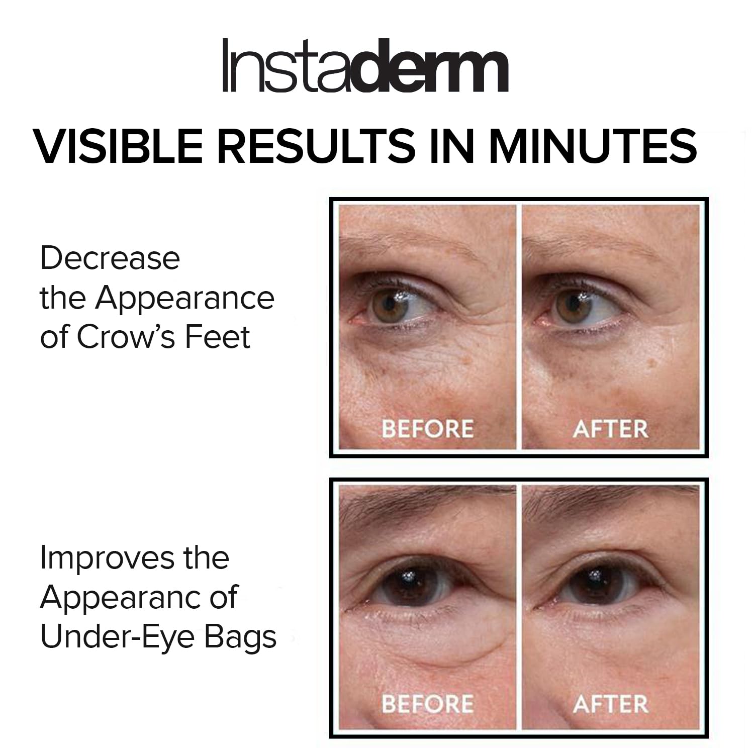 Instant Puffy Eye & Lift Treatment – Removes Under Eye Bags & Puffiness. Eliminate Dark Circles & Wrinkles. Naturally Ageless Hydrating Cream. Disappears Before Your Eyes Within Minutes.