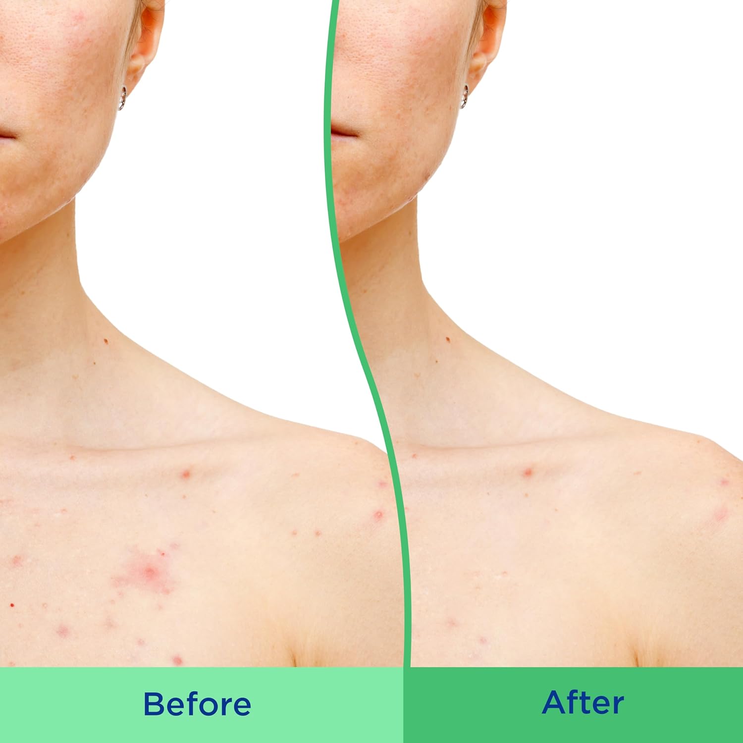 Differin Body Scrub with Salicylic Acid