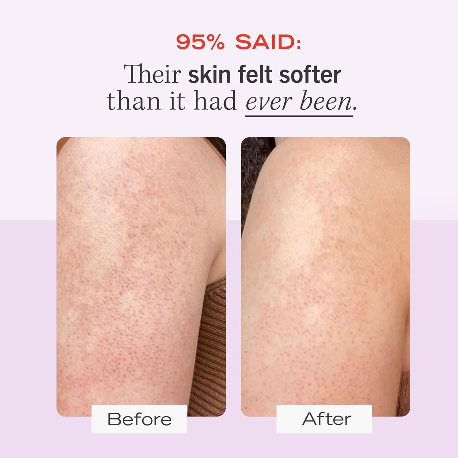 First Aid Beauty - KP Bump Eraser Body Scrub