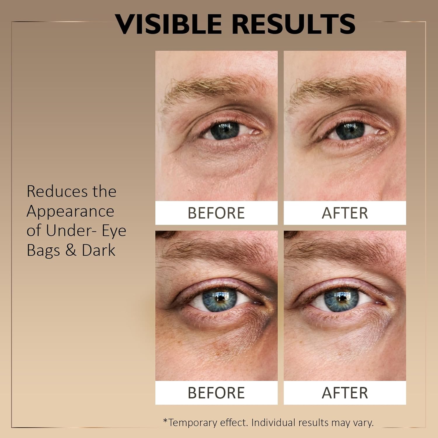 Mens Under Eye Cream for Eye Bags, Puffiness & Dark Circles with Caffeine, Bakuchiol & Niacinamide, Firms and Smooths Fine Lines, Eye Tightening, 0.67 fl oz