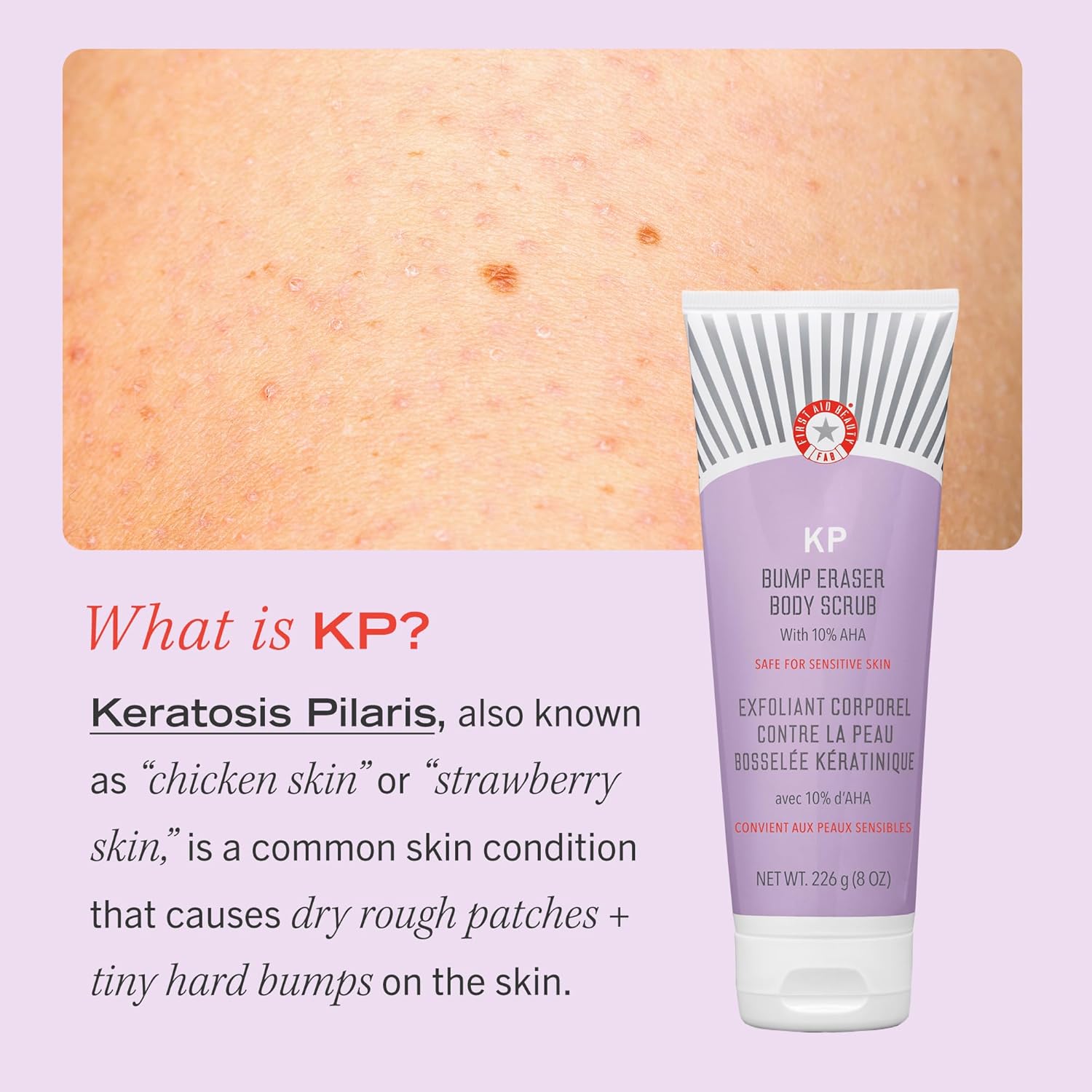 First Aid Beauty - KP Bump Eraser Body Scrub