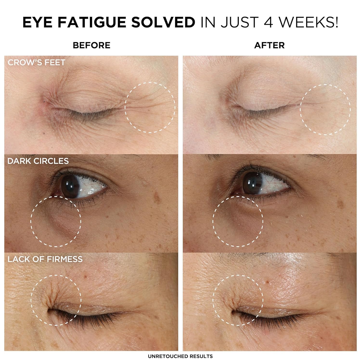 IT Cosmetics Confidence in an Eye Cream - Anti Aging Eye Cream for Dark Circles, Lightweight Formula Protects Skin Barrier, With 2% Super Peptide Concentrate, Fragrance-Free, For All Skin Types